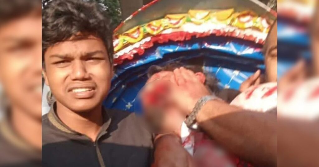 গুলিবিদ্ধ অবস্থায় ওসমান হাদি